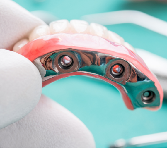 Top Dentists in Pasadena - dentist in pasadena ca Top Dentists in Pasadena - dentist in pasadena ca